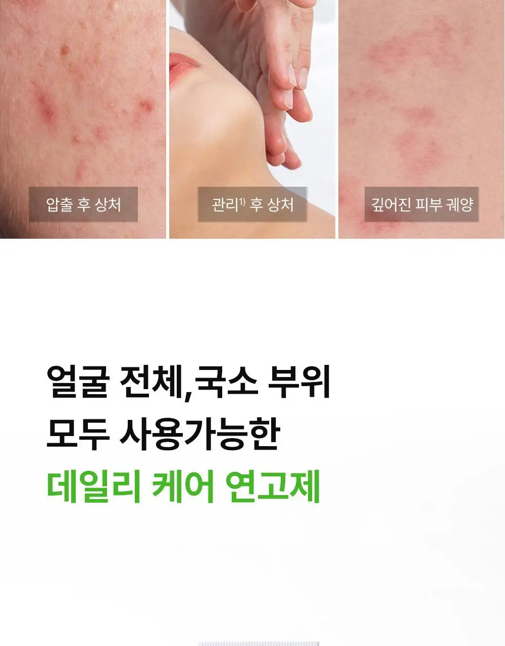[의약외품] 동아제약 센테카솔 연고 30g 상세페이지 5